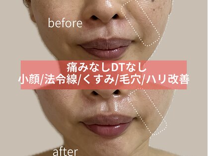 ブルーム(BLOOM)の写真