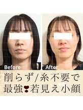 スウ(suu.)/Before-After【40代】8回