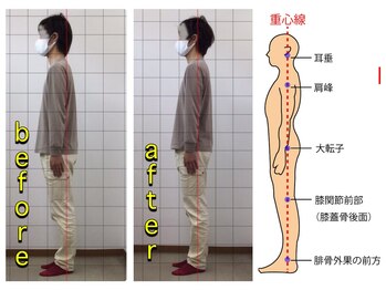 弥富整体院の写真/[通わなくてすむカラダヘ！]症状が出ない身体作りと無理のない正しい習慣を身につけて理想の身体へ/￥3500