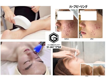 ゴールドプラス 中津店(GOLD PLUS)の写真