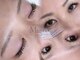 ミニョン(Mignon)の写真