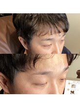 眉毛ハウス 吉祥寺店(眉毛HOUSE)/お客様の施術例(吉祥寺/東京)