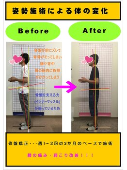 長町バランス整骨院/バランスオーダー施術!根本施術