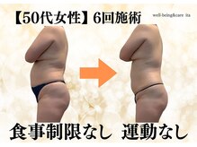 イタ 岡崎店(ita)の雰囲気（【大幅減量/短期痩せ】強圧インド式&痩身マシンで変化を実感！）