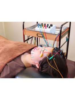 鍼灸施術を受けたい