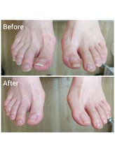 リゼラアンドコー 上越店/ドイツ式フットケア専門店