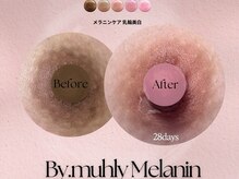 ダイア(DIA)の雰囲気（【最新技術のメラニンケア】黒ずみ除去して本来のピンク肌に♪）