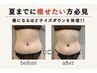 【エステ】痛み、ダウンタイムのない痩身エステ＊初回60分8800円！
