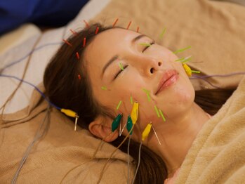 縁座や(ENZAYA)の写真/初めて美容鍼を受けられる方におすすめ☆電気美容鍼とドライヘッドスパでむくみを解消し、スッキリ小顔に♪