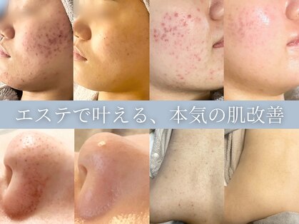 フルール(FLEUR)の写真