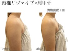 ラフェリ(Rafeli)/肩こり・巻き肩悩み