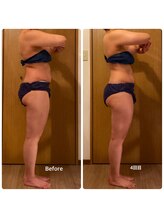 ラナン(Ranan)/BeforeAfter