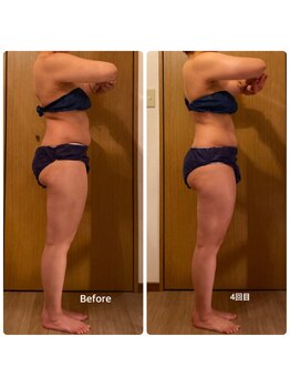 ラナン(Ranan)/BeforeAfter