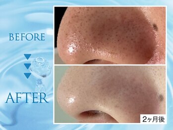 クリアラボ 錦糸町(Clear Lab)/韓国肌管理&毛穴洗浄専門店