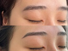 シス(sis)/美眉形成