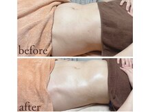 ユヴィラ(YUVIRA)/腸もみグレードアップしました！