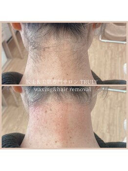 トゥルーリー(TRULY)/《うなじワックス》