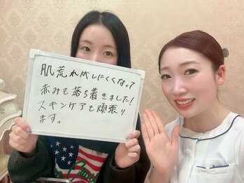 エピア 岡崎店(Epia)/長年のお悩みをEpiaで解決☆