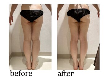 銀座レイア/ハイパーナイフビフォーアフター