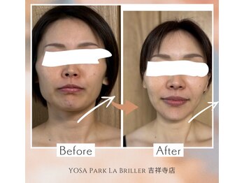 ヨサパーク ラブリエ 吉祥寺店(YOSA PARK La Briller)/ルルオン継続1ヶ月