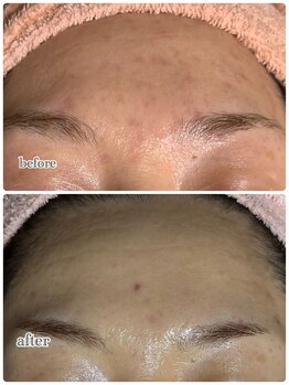 アロマ&クレイケアルーム ネロリドール(Nerolidol)/色ムラ色素の蓄積もキレイに♪1