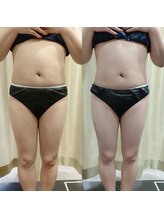 マイフェアレディ 今池(MyFairLady)/