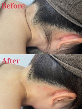 ミース 越谷店/うなじ矯正●Before、After