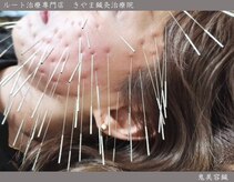 きやま鍼灸治療院