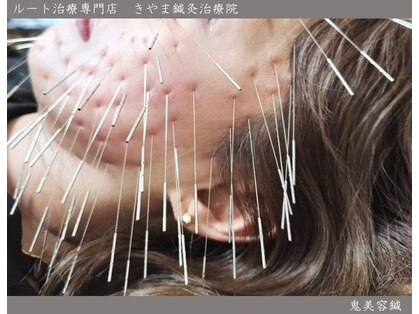 きやま鍼灸治療院の写真