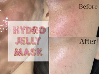 キレイ(Kirei)/赤みを抑えたい方におすすめ