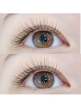 ノア(Noa.)/フラットラッシュ