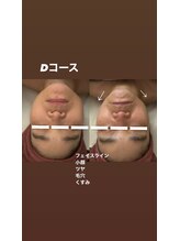 ヴィクトワール シュエット/お客様の変化