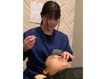 むすび接骨院 上福岡院/美容鍼♪