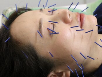 ココチ 下北沢(COCOCHI)の写真/鍼灸マッサージの国家資格者、30年以上経験あるスタッフの施術で身体の不調やお悩みを根本改善いたします◎