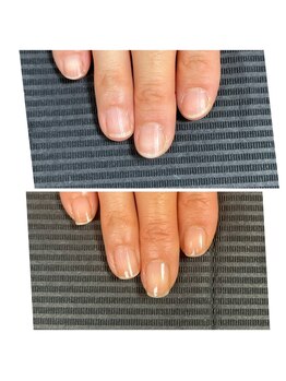 ウェルズユキ(well's yuki)/深爪矯正町田駅すぐ