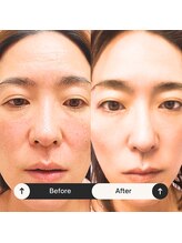 ゆう/まるで別人！8ヶ月後！