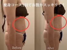 ブランリス(Blanclis)の雰囲気（下腹の脂肪がない！！自己流では落とせない脂肪も1回でスッキリ）