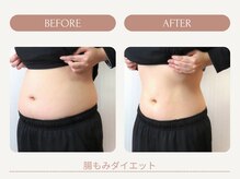 腸もみ基礎代謝がUP！便通、ぽっこりお腹、痩せやすい体に改善