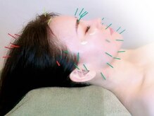 エモーション(Emotion)