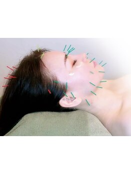 ホウレイ線・たるみ改善！予防ケア