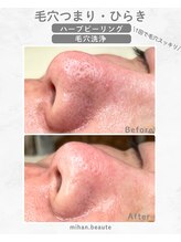 ミハン ボーテ(mihan.beaute)/