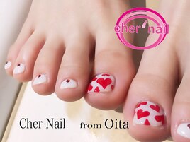 【Cher nail】