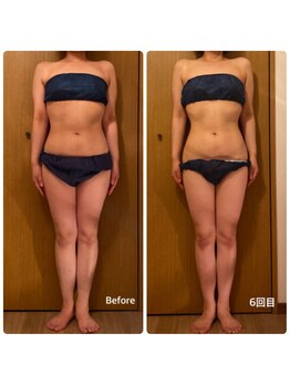 ラナン(Ranan)/BeforeAfter