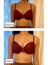 シエスタ(SIESTA)/デコルテからふっくらバストに★