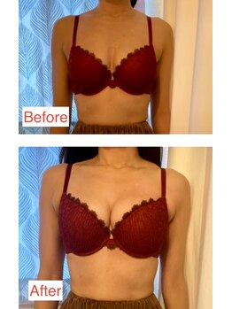 シエスタ(SIESTA)/デコルテからふっくらバストに★