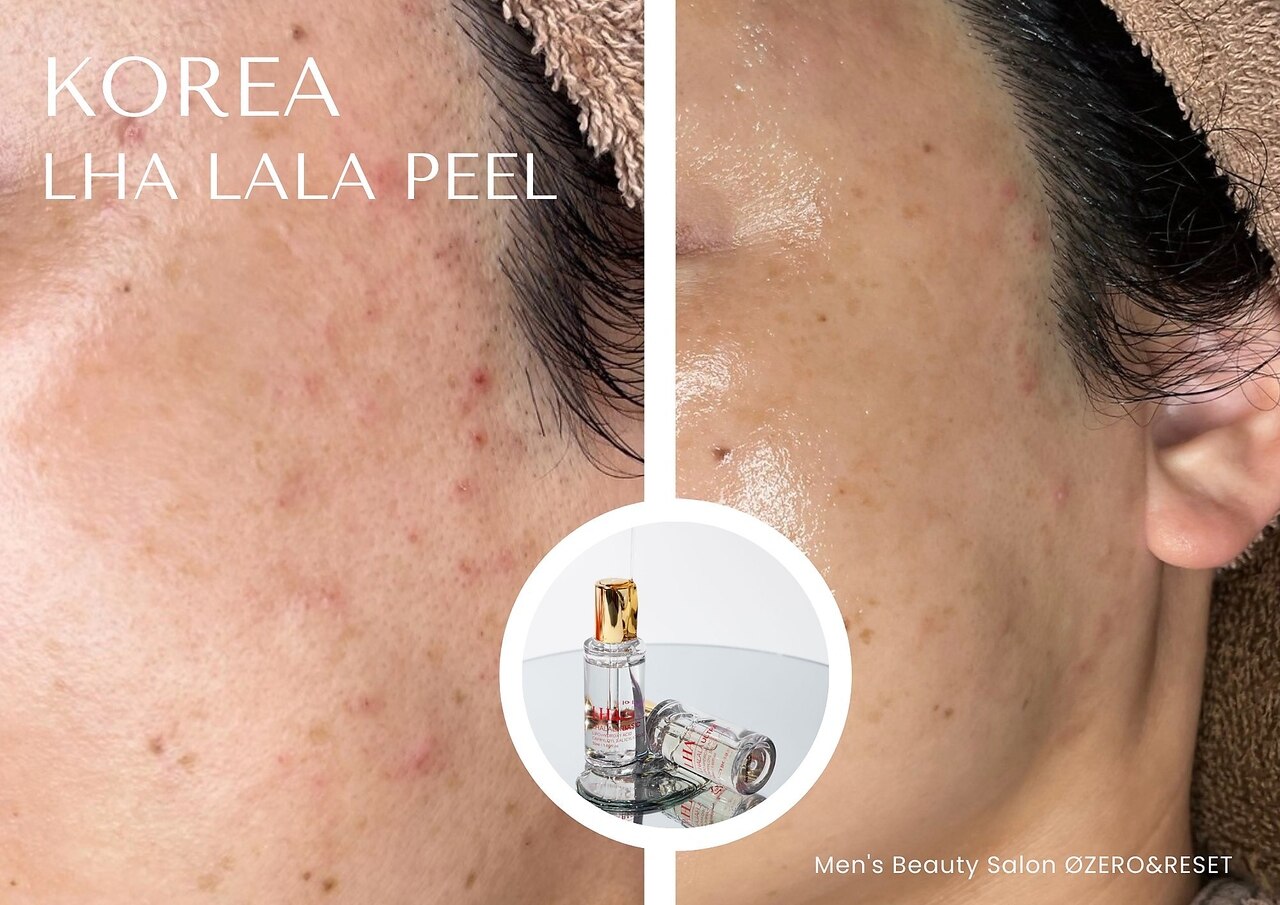 ゼロ アンド リセット(0ZERO&RESET)｜ホットペッパービューティー