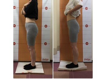 かるむ治療院 浦和店/産後矯正エクササイズ仕上がり