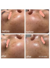 おうちサロンちか/ララピール