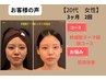 幹細胞ダーマ鍼　4回美顔コース
