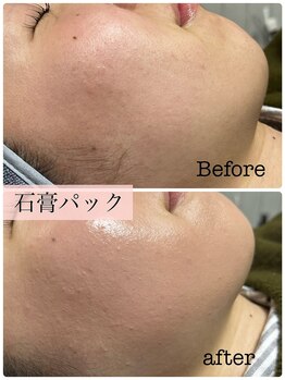 アスピリア(aspirer a')/憧れの小顔、透明感溢れる素顔へ